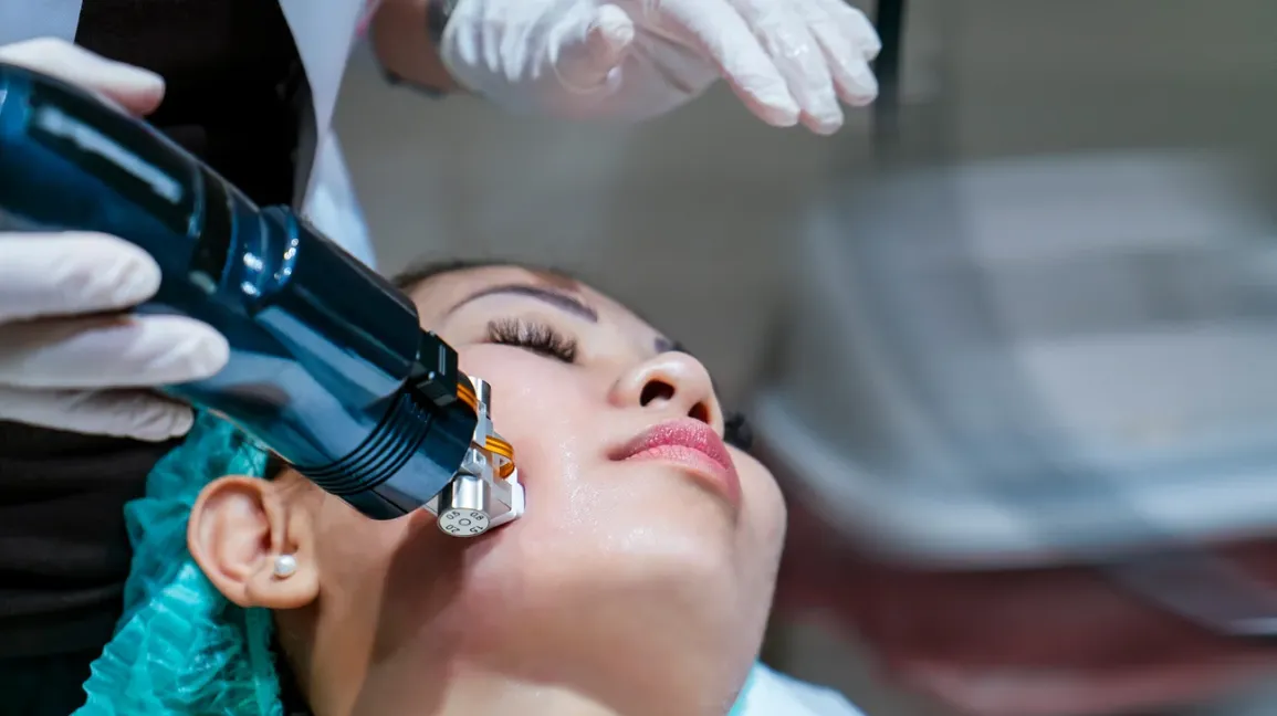 A Skin Treatment for Common Conditions – RF Microneedling